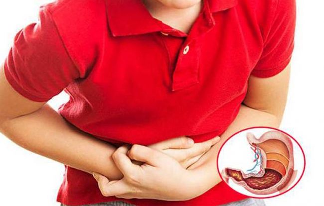 Viêm dạ dày gây ợ hơi, đau bụng trên và một số triệu chứng khác.